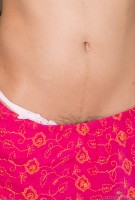 ATK hairy  in exotic and hairy