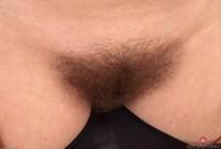 ATK hairy  in mature and hairy