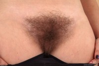 ATK hairy  in mature and hairy