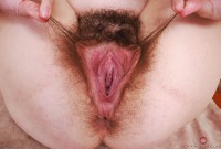 ATK hairy  in young and hairy