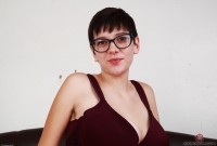 ATK hairy  in young and hairy