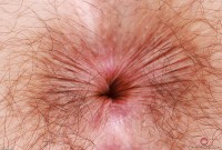 ATK hairy  in young and hairy