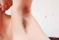 ATK hairy  in young and hairy