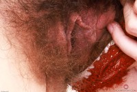 ATK hairy  in young and hairy