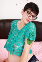 ATK hairy  in young and hairy