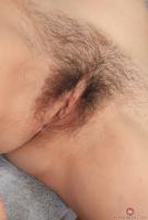 ATK hairy  in mature and hairy