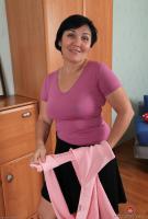 ATK hairy  in mature and hairy