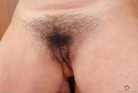 ATK hairy  in mature and hairy