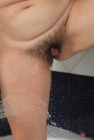 ATK hairy  in mature and hairy