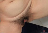 ATK hairy  in mature and hairy