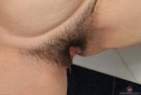 ATK hairy  in mature and hairy