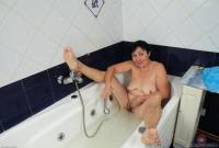 ATK hairy  in mature and hairy