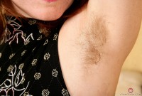 ATK hairy  in mature and hairy