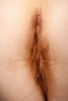 ATK hairy  in mature and hairy