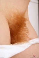 ATK hairy  in mature and hairy