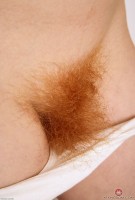 ATK hairy  in mature and hairy