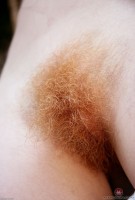 ATK hairy  in mature and hairy