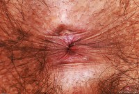 ATK hairy  in young and hairy
