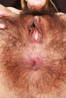 ATK hairy  in young and hairy