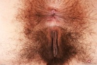 ATK hairy  in young and hairy