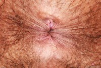 ATK hairy  in young and hairy