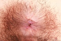 ATK hairy  in young and hairy
