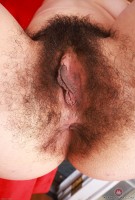 ATK hairy  in young and hairy