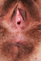 ATK hairy  in young and hairy