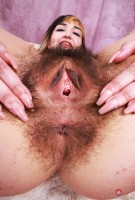 ATK hairy  in young and hairy