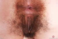 ATK hairy  in young and hairy