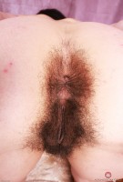 ATK hairy  in young and hairy