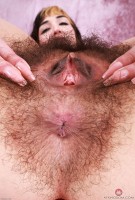 ATK hairy  in young and hairy