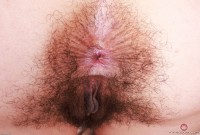 ATK hairy  in young and hairy
