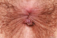 ATK hairy  in young and hairy