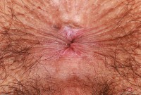 ATK hairy  in young and hairy