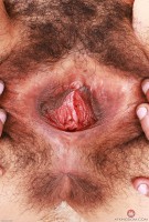 ATK hairy  in young and hairy