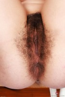ATK hairy  in young and hairy